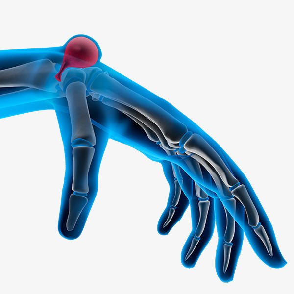 Anatomia do cisto sinovial