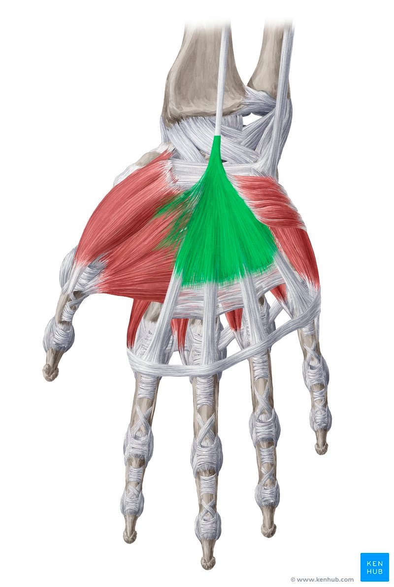 Fáscia palmar — doença de Dupuytren