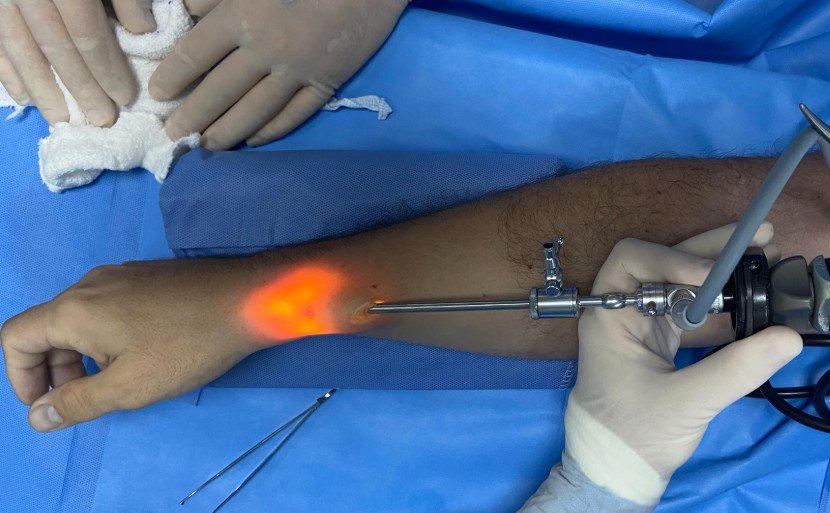 Cirurgia Endoscópica